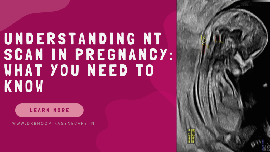 Understanding NT Scan In Pregnancy: What You Need To Know BY DR bhoomika sharma