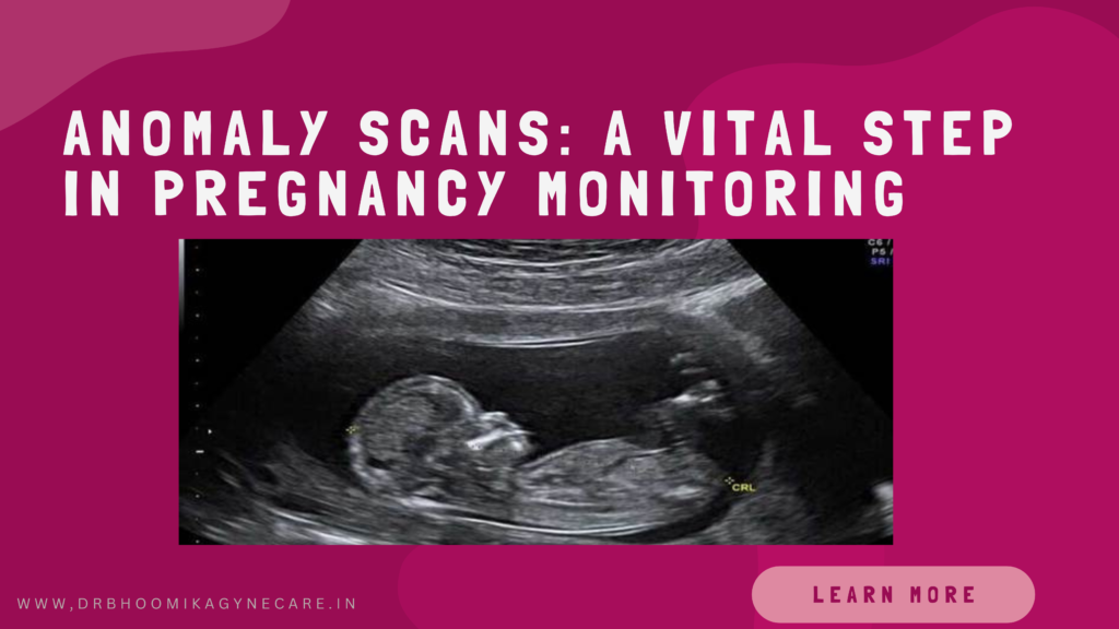 Anomaly Scans: A Vital Step in Pregnancy Monitoring